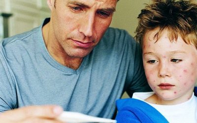 Tout savoir sur la varicelle, une maladie pas si bénigne qu’on le croit
